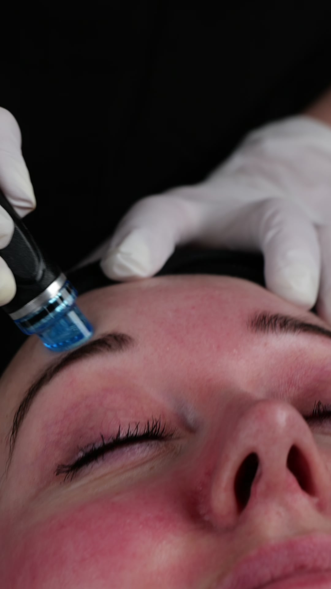HydraFacial lysande hudton hos Hudsalong Anna Maria Huskvarna